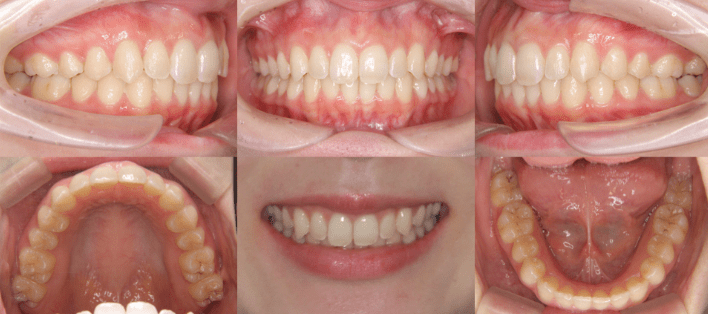 顎の手術はどうでしょうか?