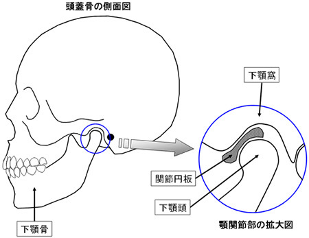 症 顎 治療 関節 顎関節症の主な治療は｜一般社団法人日本顎関節学会