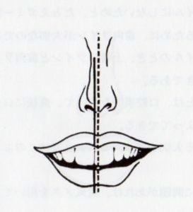 正しい位置はどこ 歯の中心のずれの治し方 上下の歯がずれている 正しい位置と歯の中心のずれの治し方 歯列矯正の基礎知識コラム 東京 エムアンドアソシエイツ矯正歯科