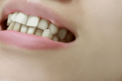 悪い歯並びが影響 歯周病の初期症状と進行チェック 歯列矯正の基礎知識コラム 東京都中央区でマウスピース矯正 インビザライン をお探しなら日本橋駅すぐ エムアンドアソシエイツ矯正歯科