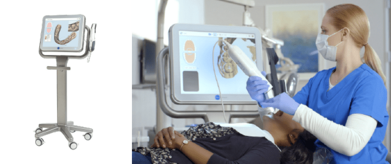 光学印象（光学スキャナー）