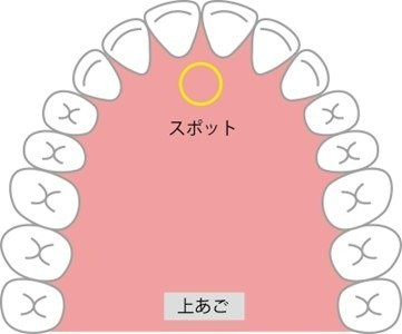 知っておきたい「正しい舌の位置」セルフチェック法と舌癖改善トレーニング方法を解説 | 歯列矯正の基礎知識コラム |  東京都中央区・マウスピース型矯正装置を用いた矯正治療専門「エムアンドアソシエイツ矯正歯科」