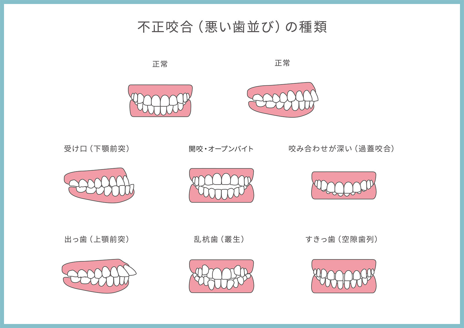 楽天ブックス: 歯の噛み合わせがすべての原因だった - 簡単Q＆A