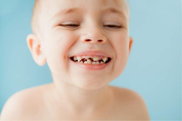 笑って歯を見せる子供