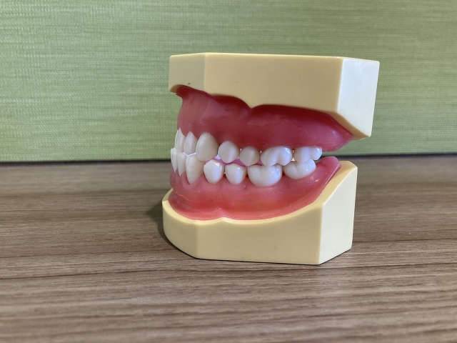 顎模型を横から見た図