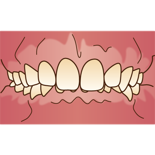 mode3_w500-kagai1.png?v=