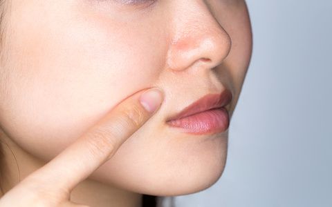 口ゴボや出っ歯でほうれい線が目立ってしまう理由と改善方法を矯正医が